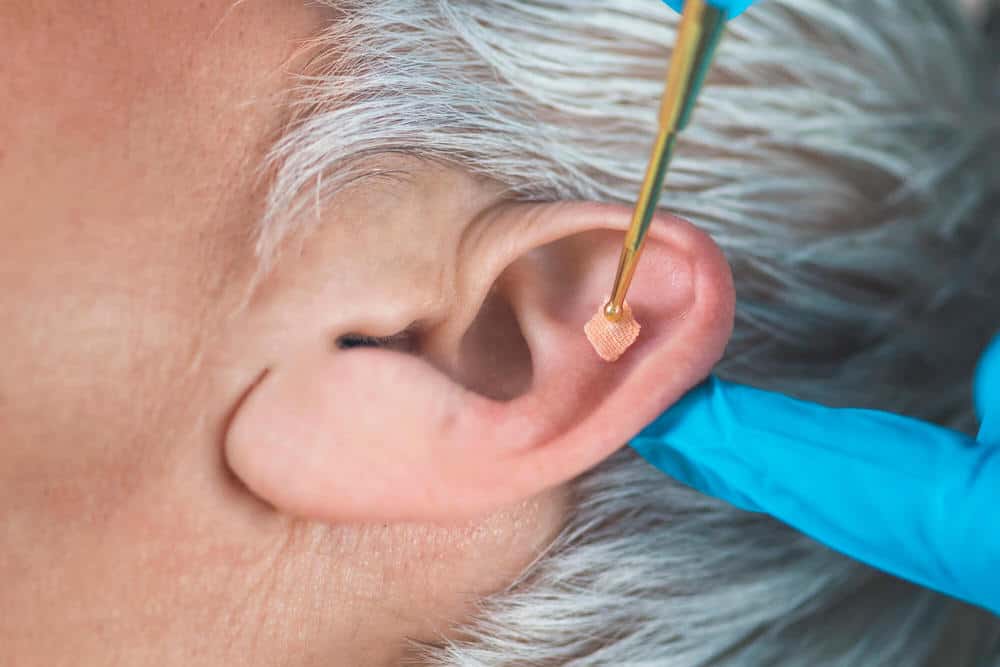 O que é Auriculoterapia
