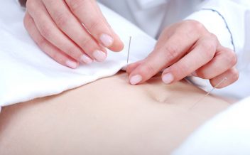 acupuntura para quedarse embarazada