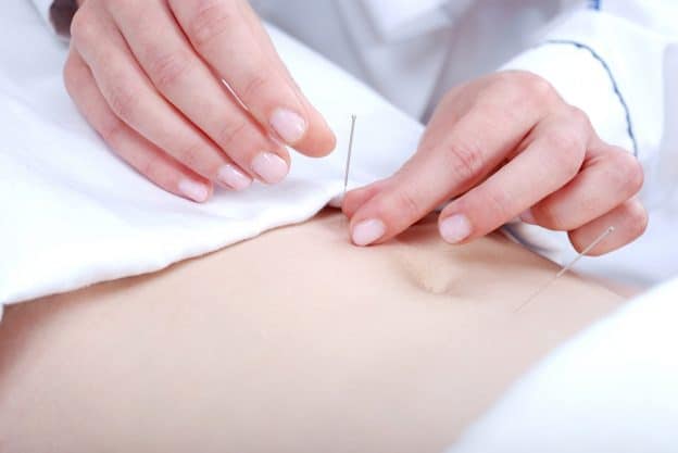 acupuntura para quedarse embarazada